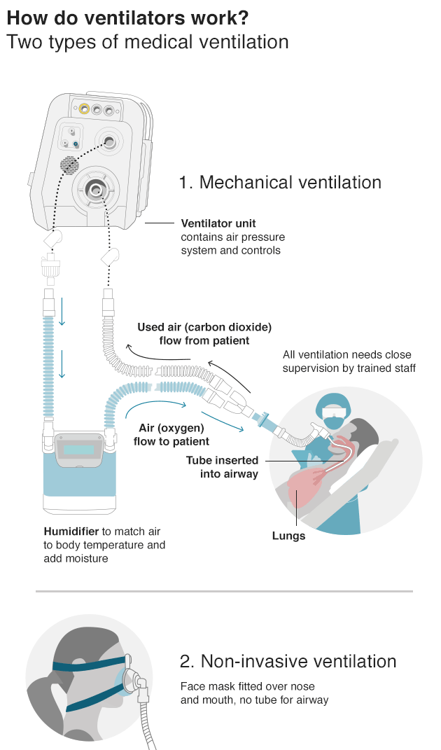 Two types of Medical Ventilation